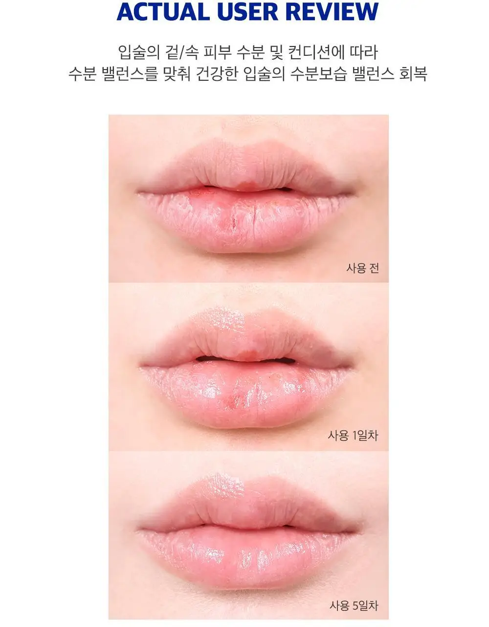 [NEW] 블리스텍스 립 메덱스 립밤 더블기획 (7g+7g) 상세페이지 4